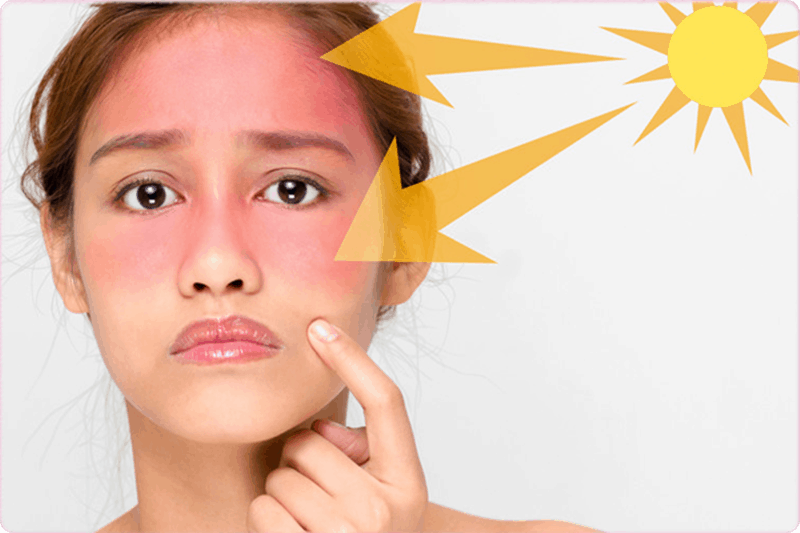 Note lại những cách giúp làn da của bạn được bảo vệ dưới ánh nắng mặt trời